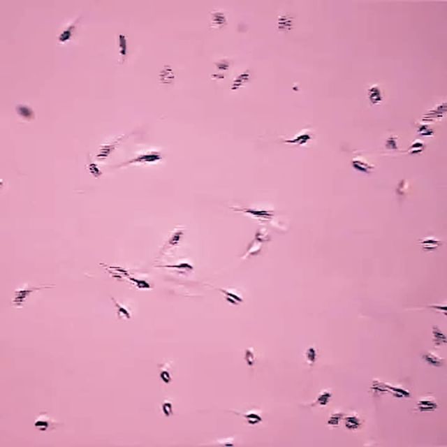 Cum under a microscope Leigh darby - my french stepson