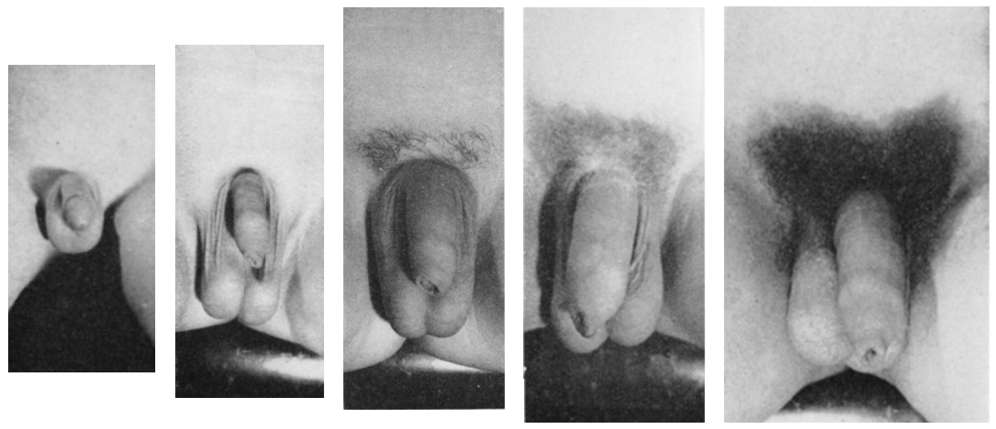 Male genitalia pictures Sasha.khalifa
