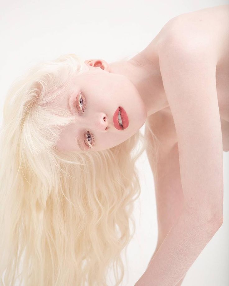 Naked albino girls Mature escorts manchester